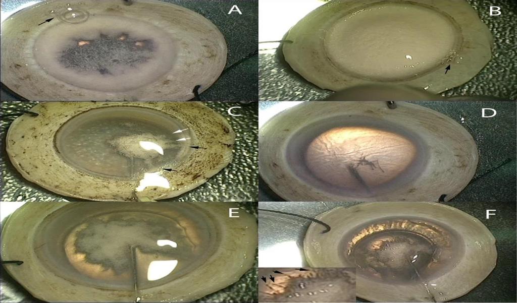 Figure 4.1 Leakage of air at the vicinity of the trabecular meshwork. Sclera-corneal discs are partially (A) and fully (B) aerated.
