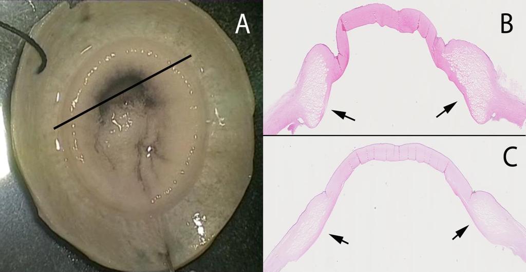 Figure 4.3 Histology of cornea with circumferential band of air. A. A circumferential band was formed after initial diffuse spread of air in the stroma.