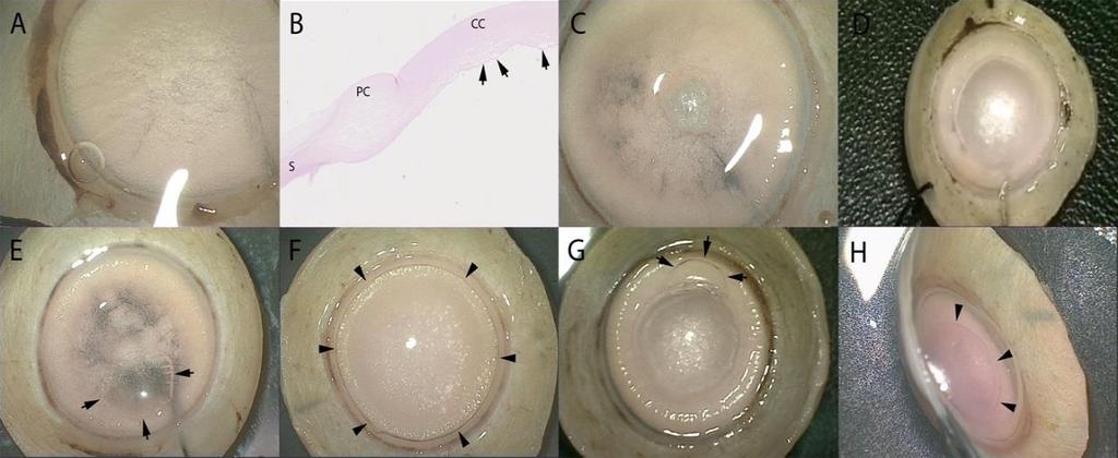 Figure 4.4 Formation of type-1 big bubble (BB). A. A cluster of tiny bubbles of air are seen in the central corneal stroma, which is fully aerated and appears white. B.