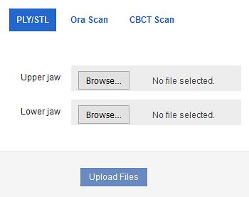 Import STL Files for Diagnostic/Final Scans 1. For Upper Jaw, click the Choose File button, select the patient s upper scan file and click Open. 2.