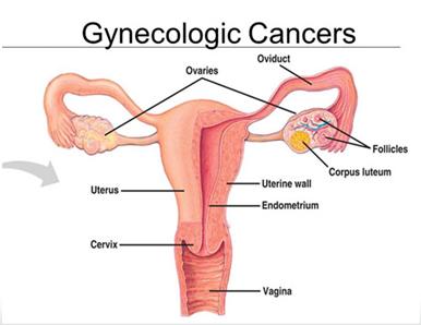 areas with limited access 7,663 women with GYN cancers annually live in