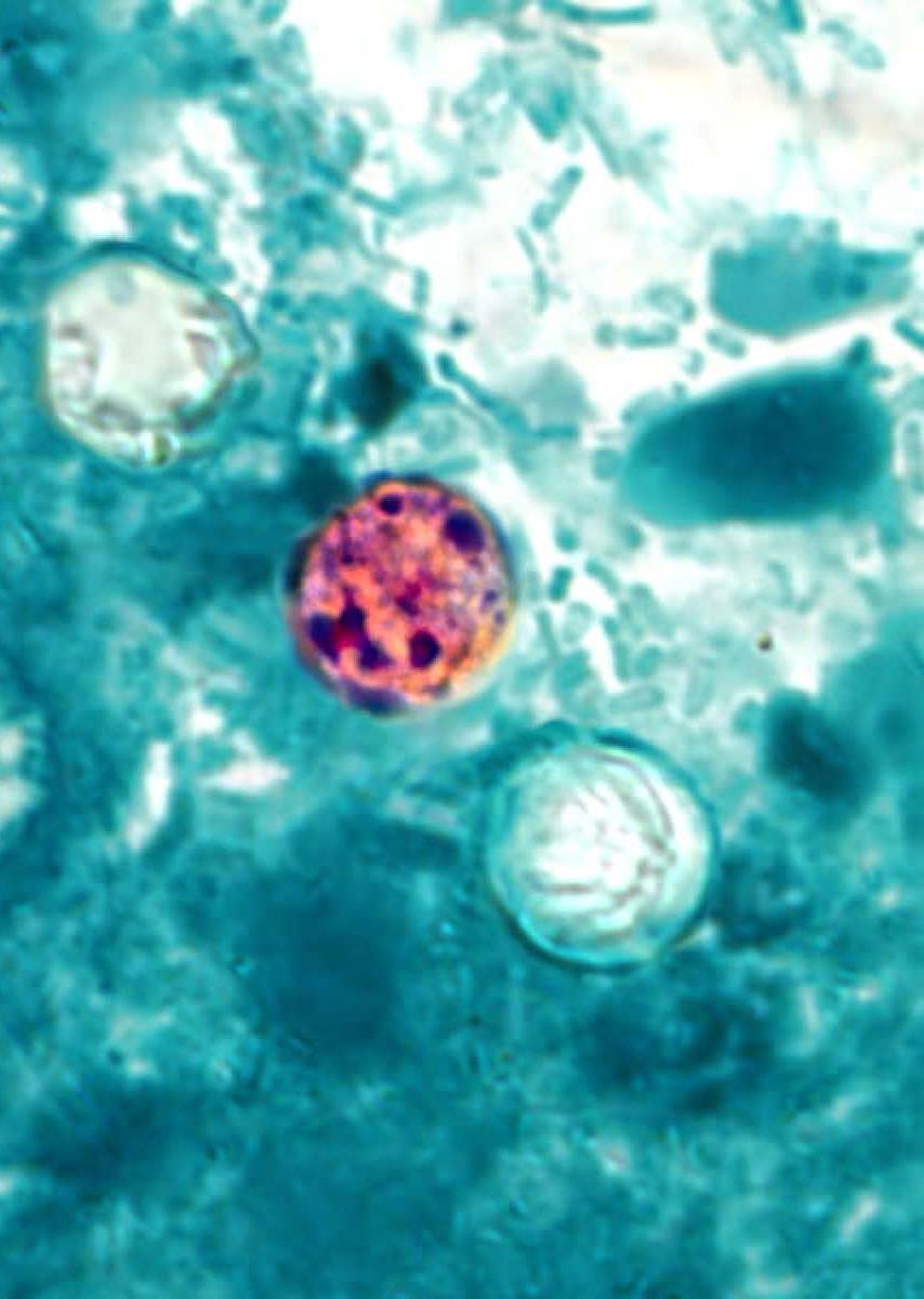 Cyclospora Intestinal parasite Not endemic in U.S.
