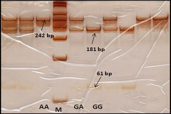 MATERIJAL I METODE Slika 1. Prikaz poliakrilamidnog gela bojenog srebrom u genotipizaciji varijante G-2548A u genu LEP. M-DNK marker 50bp 3.2.10.