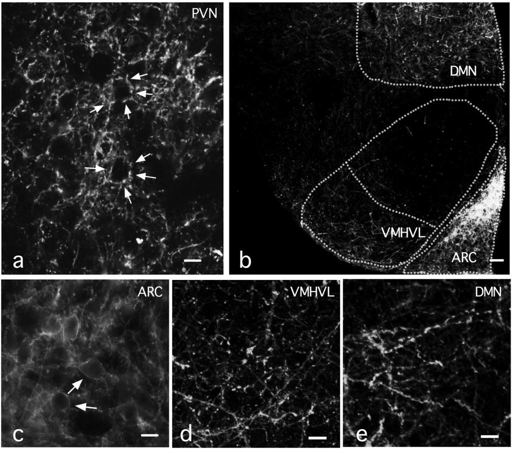 Supplementary Figure 8 (AAV)dj-ChIEF-tdTomato-mediated ChIEF-tdTomato expression in ARC and PVN a. High density of axons was found in PVN after the AAV was microinjected into the ARC.