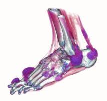 What I can see in my gout patient that I couldn t before: the role of advanced imaging in gout diagnosis and