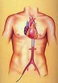 Balon de contrapulsație aortică (IABP) Balon aortă