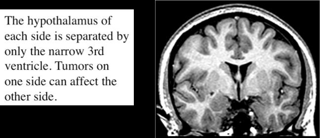 1B. Control of Water Intake Posterior Pituitary SIADH syndrome of