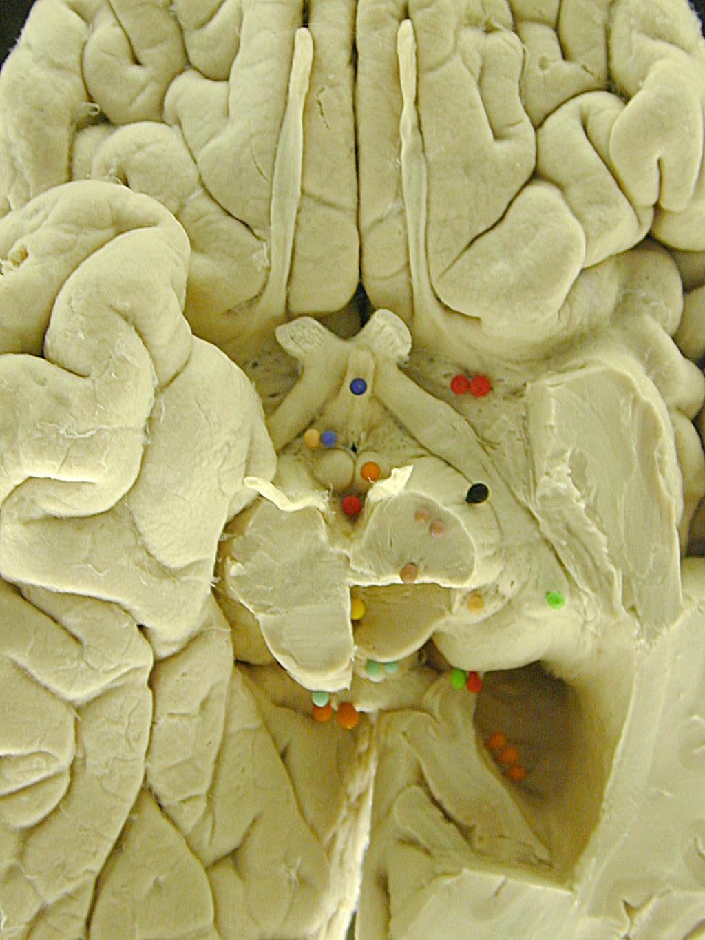 Hypothalamus Location At the base of the hemisphere w borders: midbrain, thalamus, 3rd ventricle, optic chiasm It has