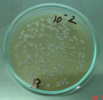 Identification of bacteria Tests Results Phenotypic characterization Gram s stain Gram positive, small rod, in single or pair form Catalase test - Sugar fermentation test Lactose, glucose, sucrose,