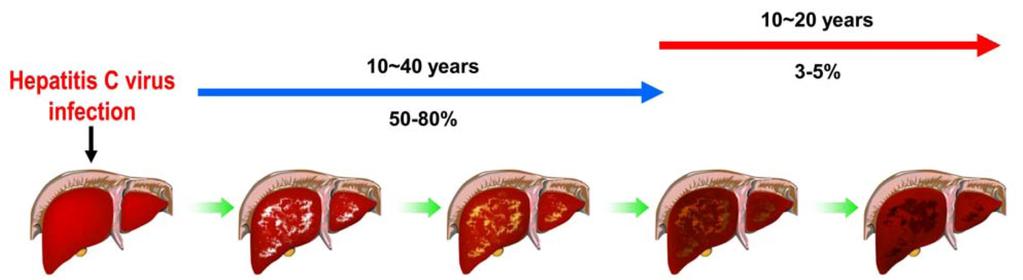 Pathogenesis of HCV infection Normal Chronic Liver Liver Hepatocellular Liver Infection Steatosis Cirrhosis Carcinoma Ke and Chen (2012)