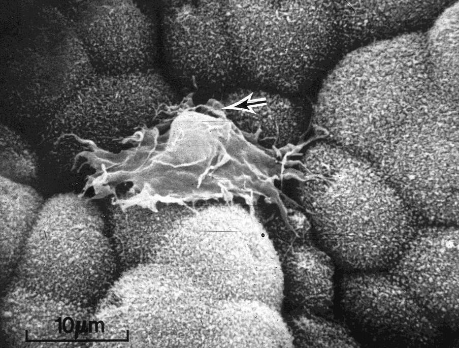 smallest glia Phagocytic
