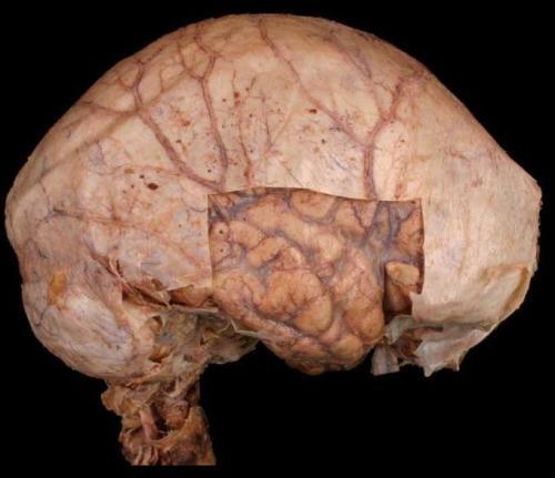 surface of the skull Meningeal layer outer