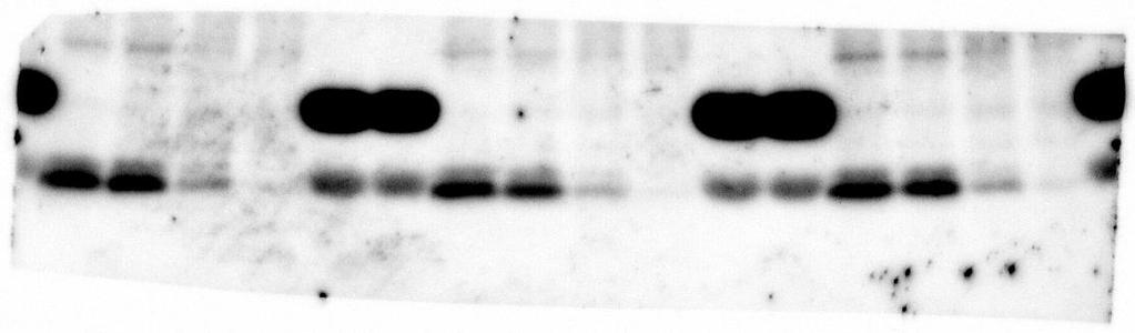 b-actin was used as an internal control. Blots in a black line box are originated from the same gel.