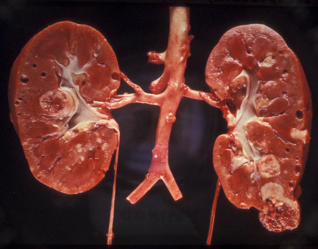 Kidneys -