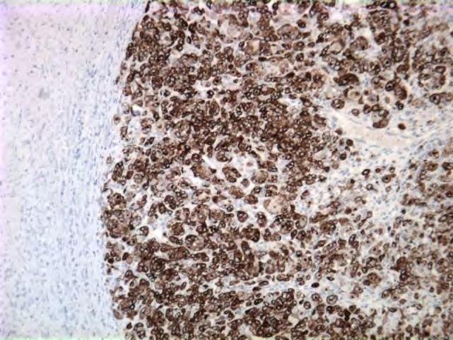The role of immunohistochemistry in surgical pathology of the uterine corpus and cervix Prof.