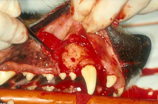 Lavaža alveole i postavljanje flapa (7 sec) Šivenje flapa (43 sec) Ponekad je poželjno i nakon vađenjazuba odraditi RTG snimanje kako bi se uverili da je su uklonjeni svi delovi zub kao i da nismo