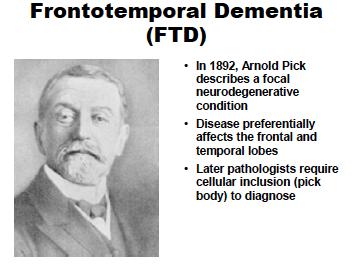 Clinical features of FTD include decline in personal hygiene and grooming, mental rigidity and inflexibility, distractibility and impersistence, Common cause of early