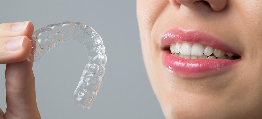 4. Do They Provide Free Lifetime Retainer Checks? A great orthodontist will stand behind their treatment, and one of the best ways to do that is to offer free lifetime retainer checks after treatment.