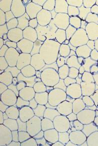 A B Mean adipocyte area (µm 2 ) C 4 3 2 1 Vessel density (n/1 4 µm 2 ) 5 4 3 2 1
