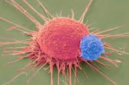 Cancer Patients Less Toxicity & More Targeted Therapy Changing the Cancer Treatment Landscape Profound