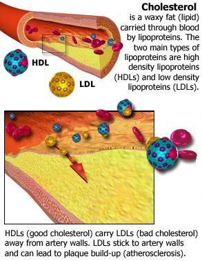 Small LDL particles are the most