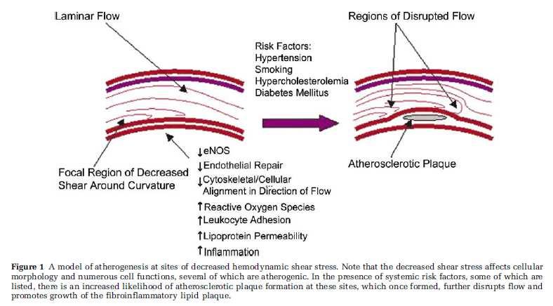 Atherosclerosis is