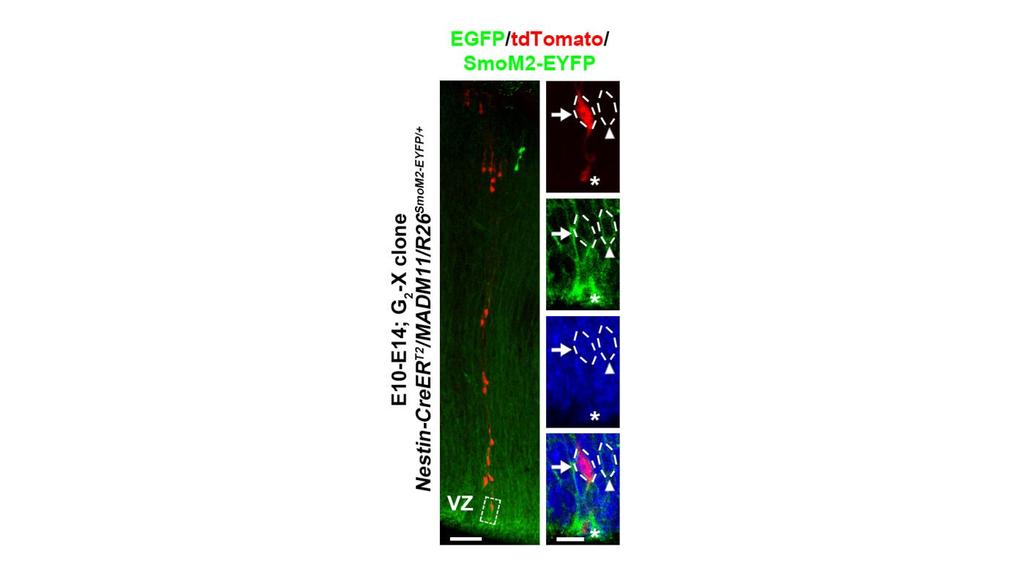 Supplementary Figure 10 Expression of SmoM2-EYFP in MADM-labeled thalamic clones.