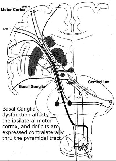From Niewenhuys, The Human Nervous System If there is pathology in the basal ganglia, it affects the ipsilateral motor cortex, and clinical deficits (via the pyramidal tract) are expressed on the