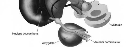 Amygdala Putamen Caudate nucleus