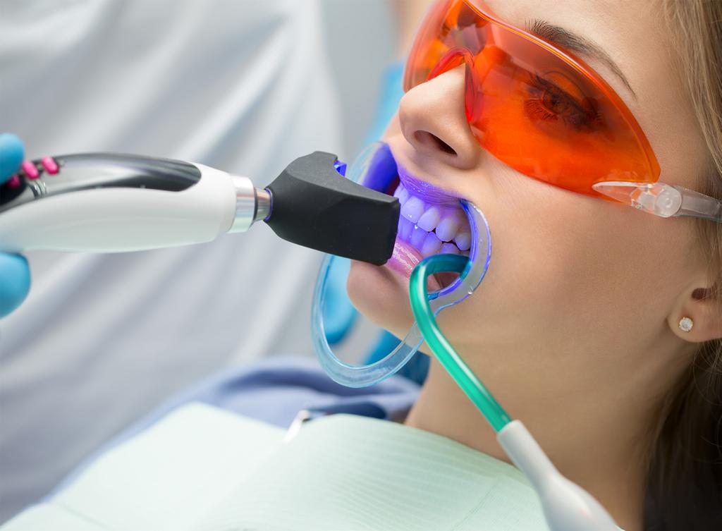 Options for Teeth Whitening Generally speaking, there are two types of teeth whitening both of which are offered at our Penn Dental Family Practice offices.