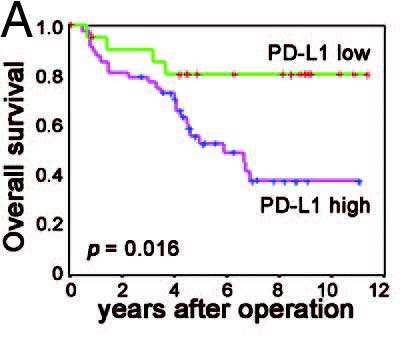 PD-L1 and tumor infiltrating CD8 + T lymphocytes are prognostic factors of human ovarian cancer