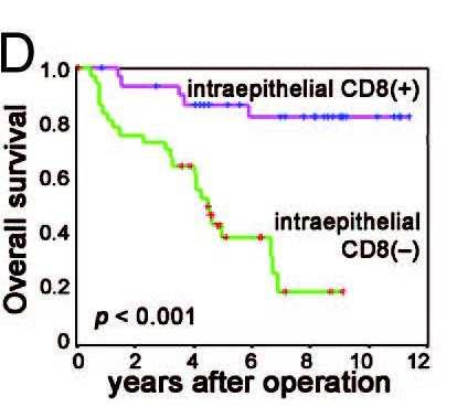 Correlation between OS and PD-L1 expression Correlation between OS and intraepithelial CD8 + T