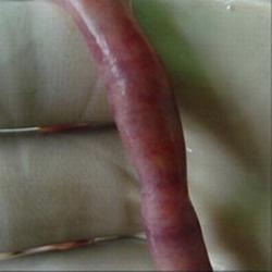 perfringens) shows the normal duodenum. Fig. 3.