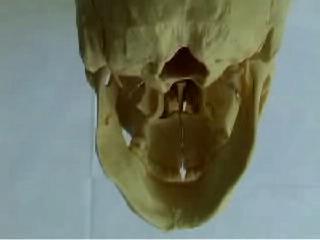 the greater the distortion in the cranium. Figure 19. Cranium showing distortions in Occipital bone, sphenoid and mandible In order to evaluate head posture we need to look at the entire body.