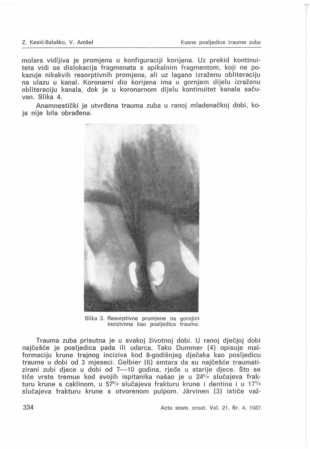 2. Kesić-Baiaško, V. Amšel Kasne posljedice traume zuba molara vidljiva je promjena u konfiguraciji korijena.