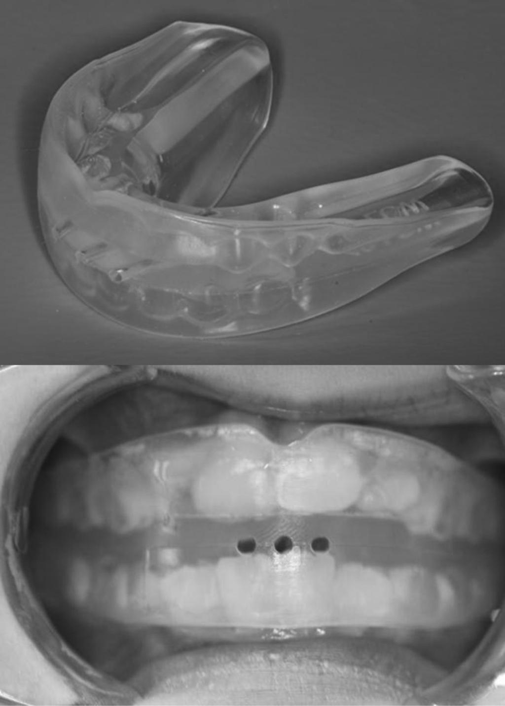 130 European Journal of Orthodontics, 2015, Vol. 37, No.