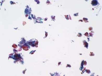 Conventional cytology