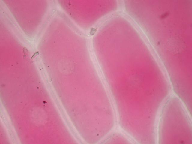 Red Onion Plasmolysis Observation Before and after observations of red onion epidermis under the