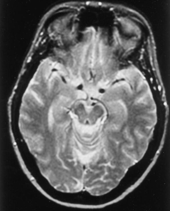 Paraclinical investigations - MRI