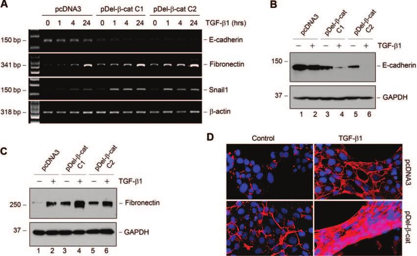 (A) Ectopic expression of -catenin promotes TGF- 1-mediated suppression of E-cadherin and induction of fibronectin and Snail1, as shown by RT-PCR analyses.