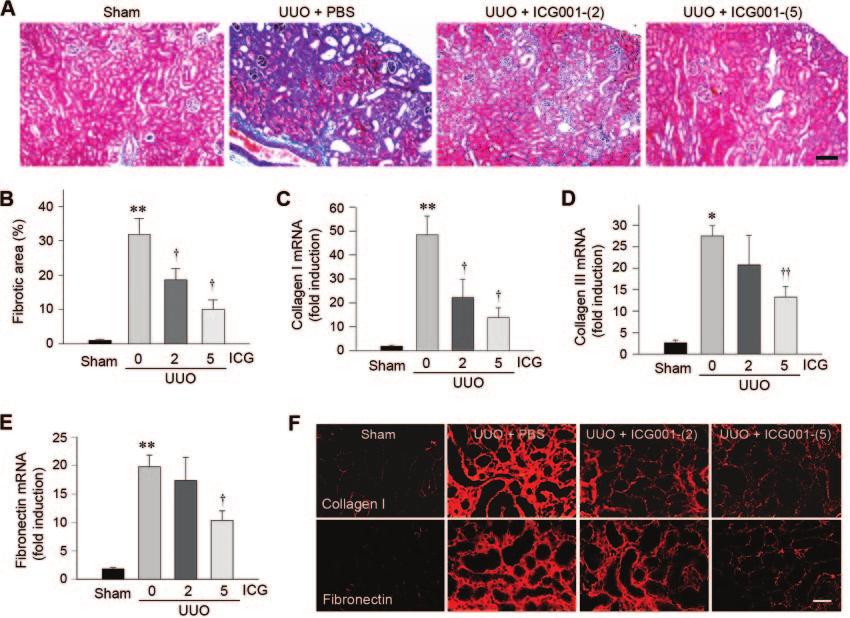 www.jasn.org BASIC RESEARCH Figure 6. ICG-001 attenuates renal interstitial fibrosis in obstructive nephropathy.
