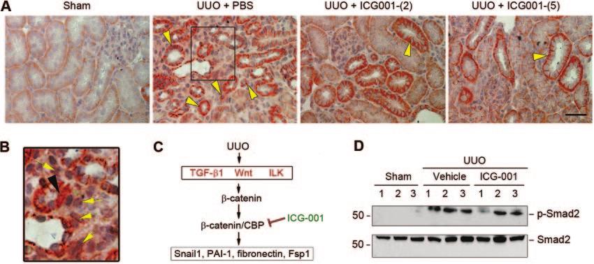 www.jasn.org BASIC RESEARCH Figure 8. ICG-001 elicits its antifibrotic effects by a Smad-independent mechanism in obstructive nephropathy.