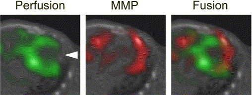 Molecular Imaging Remodeling New tracers developed for cardiologic and oncologic indications Imaging of