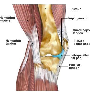 3. Fat Pad Syndrome. Also known as Hoffa s Syndrome, this is a condition where a fat pad (coloured blue below) situated behind the kneecap becomes inflamed, producing pain.