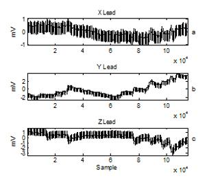 28 C. Bunluechokchai and T. Leeudomwong: Discrete Wavelet Transform-based Baseline... (26-31) Fig.