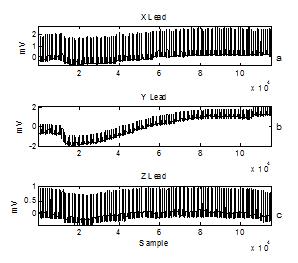 30 C. Bunluechokchai and T. Leeudomwong: Discrete Wavelet Transform-based Baseline... (26-31) Fig.