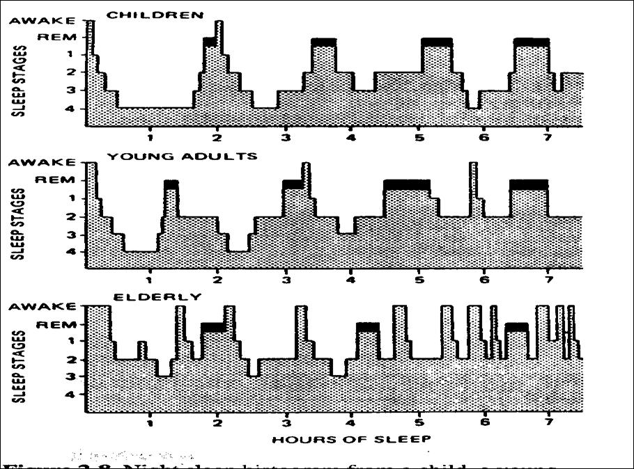 Pattern of Sleep Progression of Sleep Across the