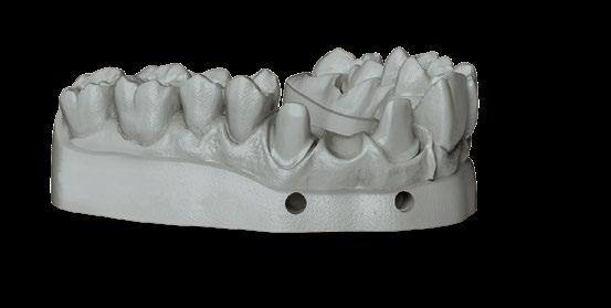 orthodontic models where high precision is needed.