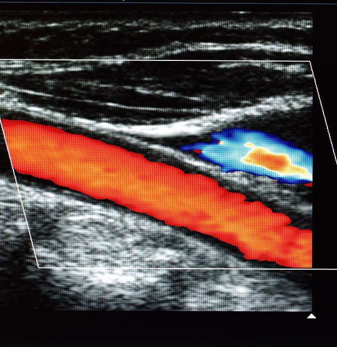 Ultrasound imaging uses sound waves to produce pictures of muscles, tendons, ligaments and joints throughout the body.