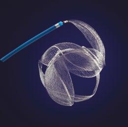 MEDINA EMBOLIZATION DEVICE ACUTE ISCHEMIC STROKE SOLUTIONS The MED Implant is a Nitinol micro-braided 3D composite mesh device incorporating a platinum core wire and
